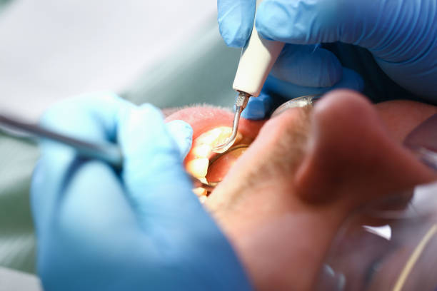 Best Emergency Gum Pain Relief  in Jamestown, OH