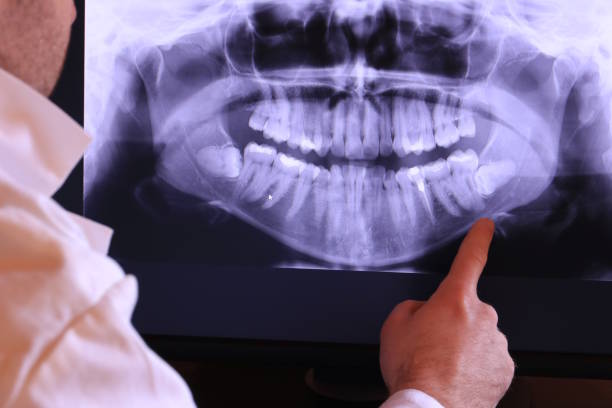 Best Root Canal Emergency Dentist  in Jamestown, OH