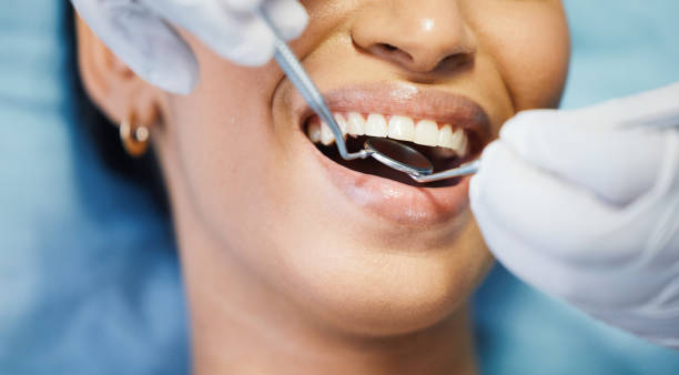 Best Knocked-Out Tooth Emergency  in Jamestown, OH