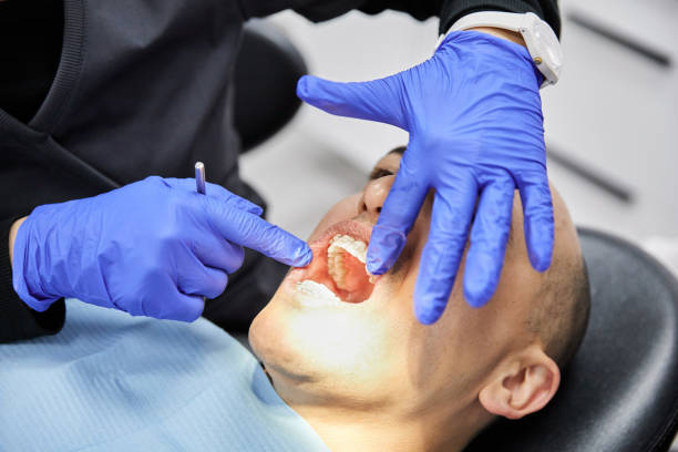 Best Tooth Infection Emergency Dentist  in Jamestown, OH