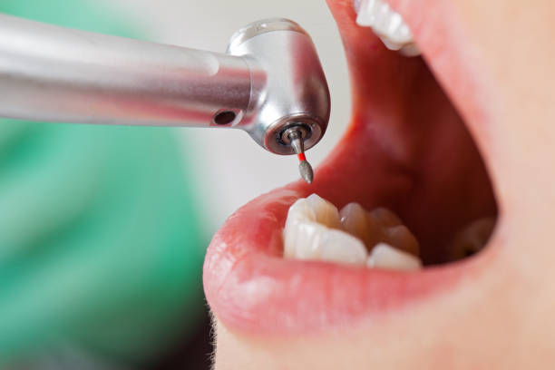 Best Broken Tooth Emergency  in Jamestown, OH
